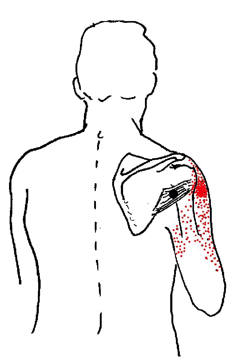 ROUND EARTH PUBLISHING: INTRODUCTION TO SHOULDER PAIN